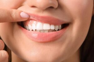 Persona mostra i denti