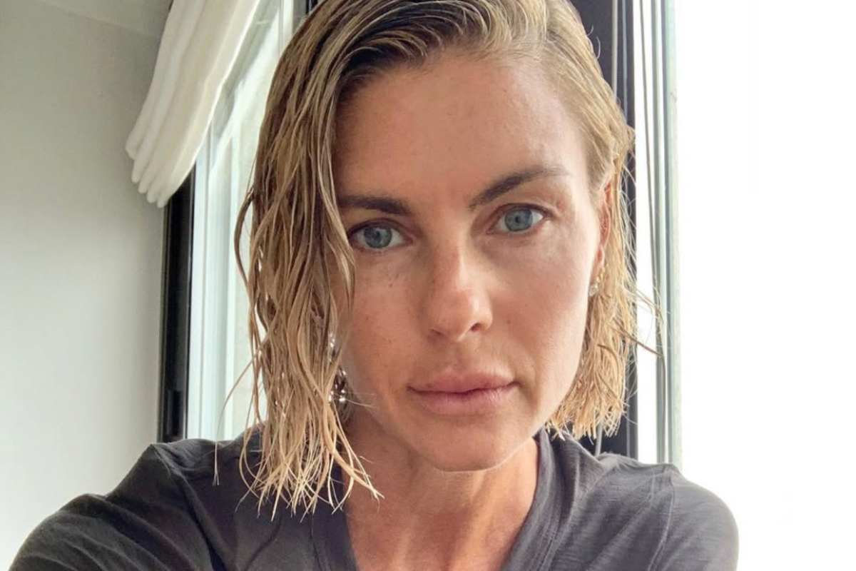 Martina Colombari, l’attrice mostra la ferita che si è provocata: “Quanto male fa” – FOTO