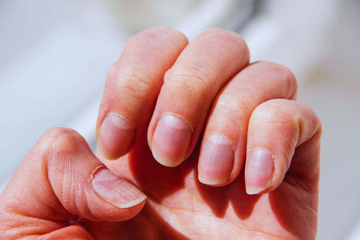 Donna che si guarda le unghia di una mano